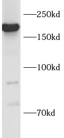      anti- Nestin antibody