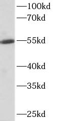      anti- ALDH1A1 antibody