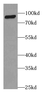      anti- Complement factor B antibody