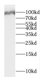      anti- DMGDH antibody