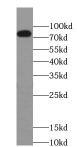      anti- Granulin antibody