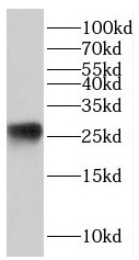      anti- HN1 antibody