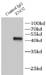      anti- NSE antibody