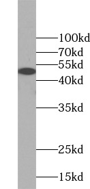      anti- NSE antibody