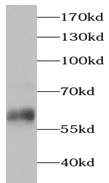      anti- Peripherin antibody