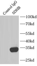      anti- SDHB antibody