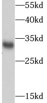      anti- SDHB antibody