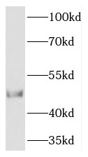 anti- TCN2 antibody