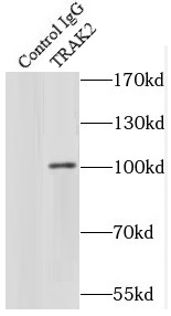      anti- TRAK2 antibody