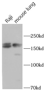      anti- PXDN antibody