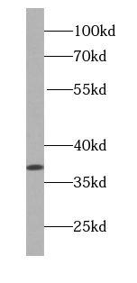      anti- B23 antibody