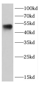      anti- Caspase 2 antibody