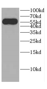      anti- CBLL1 antibody