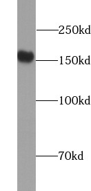      anti- CD13 antibody