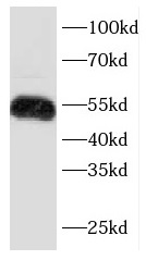      anti- Cytokeratin 7 antibody