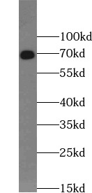      anti- DMD antibody