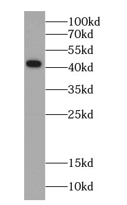      anti- Gamma cystathionase antibody