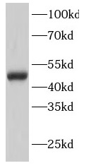      anti- GATA3 antibody