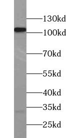      anti- HSPH1 antibody