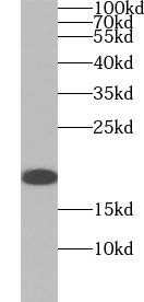      anti- IL2 antibody