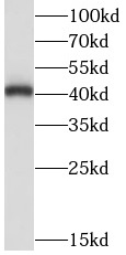 anti- LIAS antibody