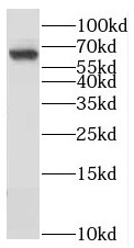      anti- NAGS antibody