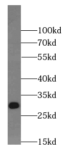      anti- Neurotrophin 4 antibody