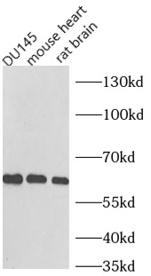      anti- NOX1 antibody