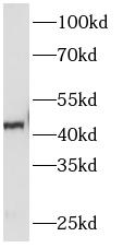      anti- PAI-1 antibody