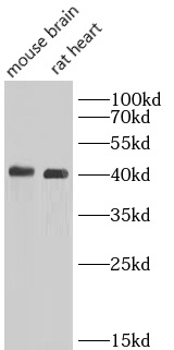      anti- PKA C-alpha speicifc antibody