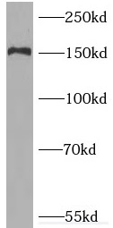      anti- PNPLA6 antibody