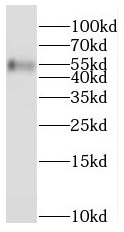 anti- PPAT antibody