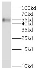 anti- PPAT antibody