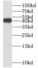 anti- PSAT1 antibody