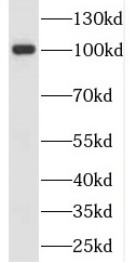      anti- PSMA/GCPII antibody