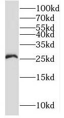      anti- RNF170 antibody