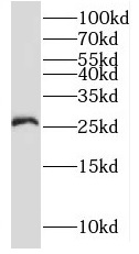      anti- RNF170 antibody