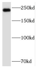      anti- SCN9A/Nav1.7-Specific antibody