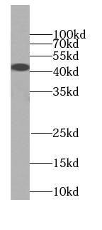      anti- SIRT2-Specific antibody