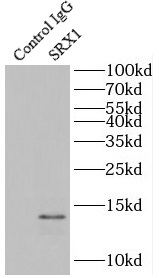      anti- SRX1 antibody