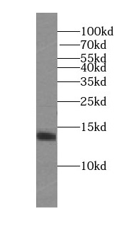      anti- SRX1 antibody