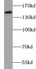      anti- XDH antibody