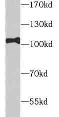      anti- TOP1 antibody