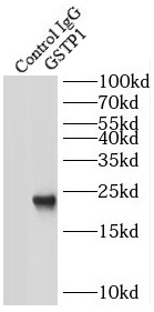      anti- GSTP1 antibody