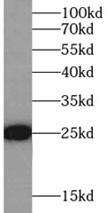      anti- GSTP1 antibody