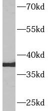      anti- AQP9 antibody