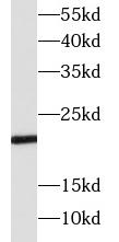      anti- SOCS1 antibody