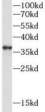      anti- CTLA4 antibody