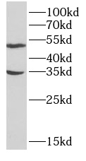      anti- APOE antibody