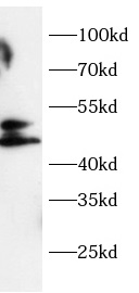 anti- MICB antibody